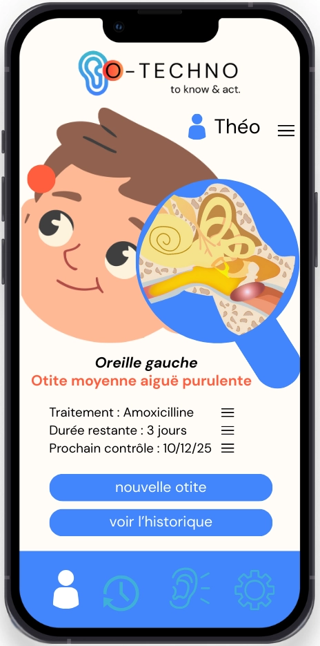 ecran-oreille-gauche-application-mobile-otechno Écran Oreille Gauche Application Mobile pour la Détection d'Otites | O-TECHNO