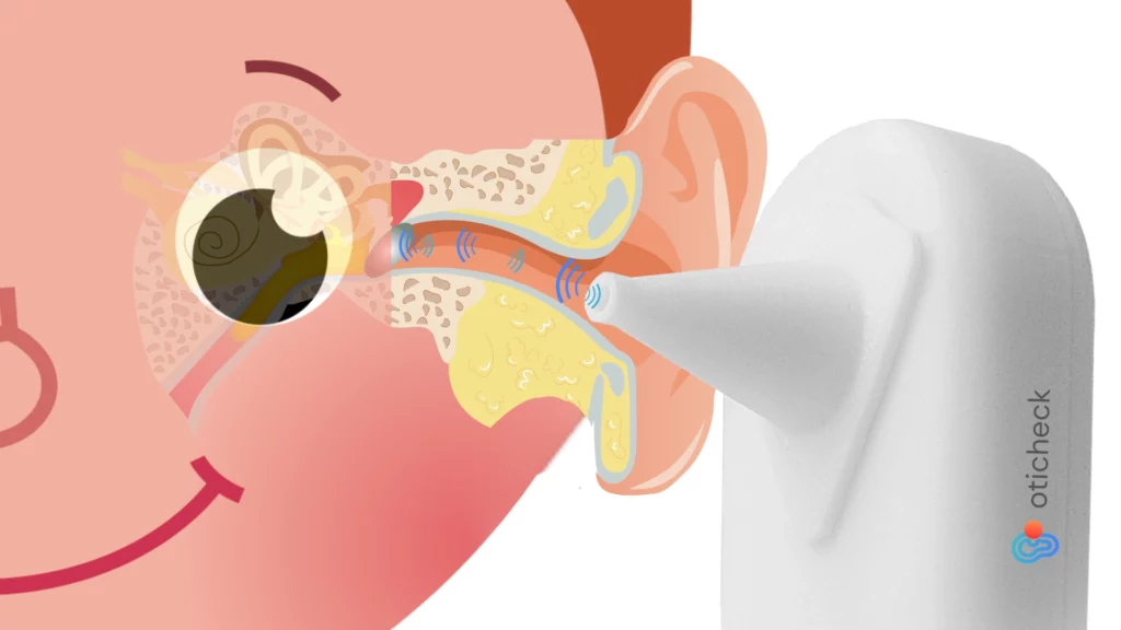 oticheck-schema-otechno Schéma d'utilisation d'OTICHECK | OTECHNO